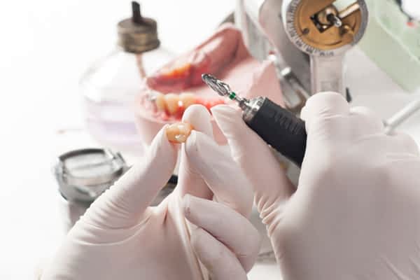 Próteses | Grupo Lien: Clínica Odontológica Completa